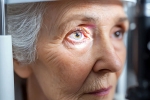 Glaucoma health checkup, Glaucoma symptoms, all about the eye disease glaucoma, Glaucoma