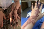 is brown henna safe, how long does black henna reaction last, henna tattoo cause aussie woman to almost lose her hand, Aswan