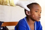 Monkeypox Outbreak new, Monkeypox Outbreak news, is monkeypox outbreak coming to india, Mpox