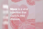 Mpox, mpox in Sweden, mpox emergency again, Mpox