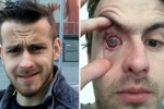 is it bad to shower with contacts, why can't you wear contact lenses in the shower?, contact lens wearers beware man goes blind after parasites eat man s eye as he wore lenses in shower, Eyesight