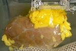 Universal Kidney new updates, Universal Kidney developed, scientists develop universal kidney transplanted to any blood group, Research