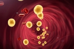 Cholesterol for health, Cholesterol Statins, tips to lower cholesterol when statins don t work, Chole