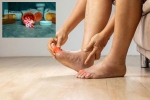 Gout Drugs breaking, Gout Drugs on heart stroke, gout drugs may cut the risk of heart attack, Face Gout Drugs breaking, Gout Drugs on heart stroke, gout drugs may cut the risk of heart attack, Face