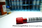 Hemophilia doctors, Hemophilia research, why are men likely to develop hemophilia, Episodes